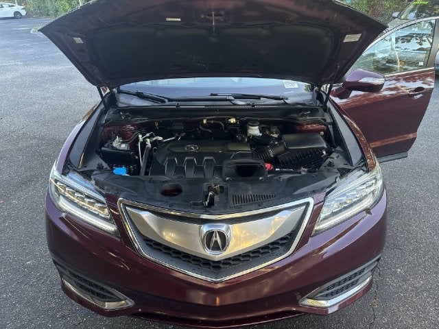 2017 Acura RDX AcuraWatch Plus Package